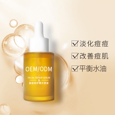 乌海市_祛痘精华原液OEM